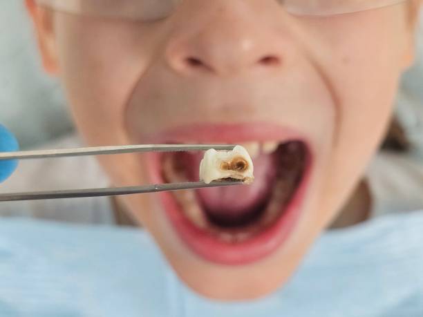 Professional Emergency Dental Service in MT